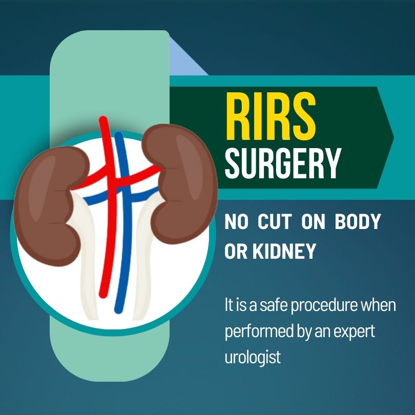 RIRS Surgery