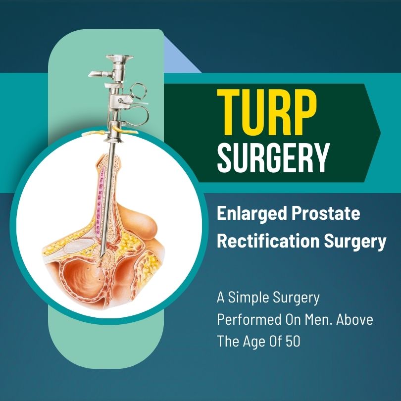 TURP Surgery