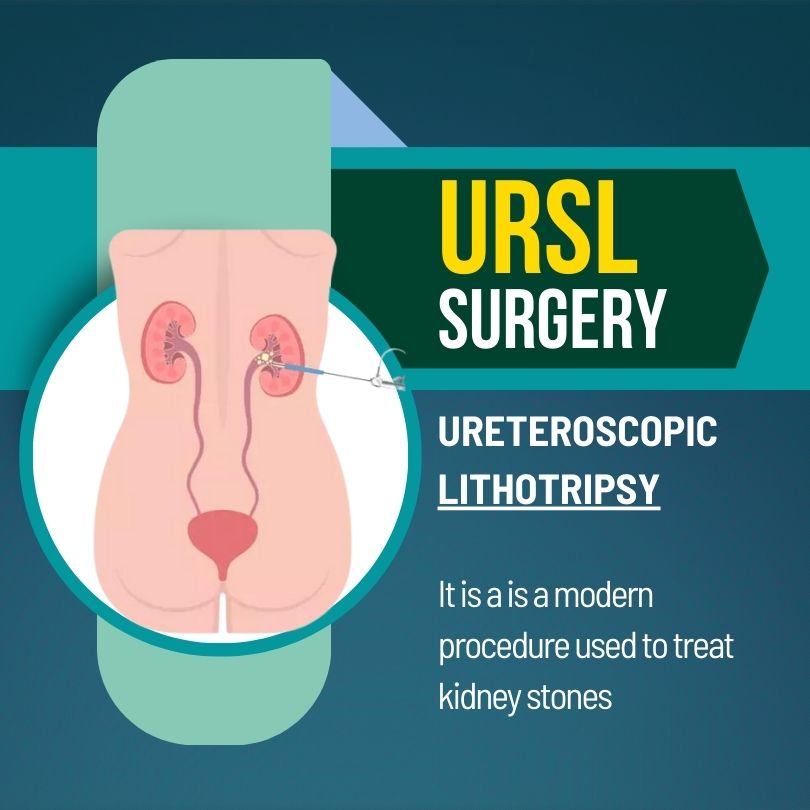 URSL Surgery