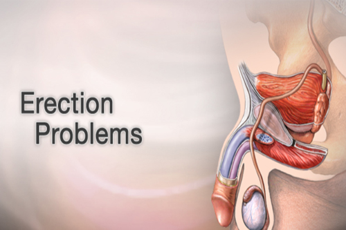 Erection Problem image explain