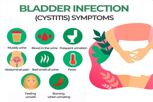 Bladder Infection